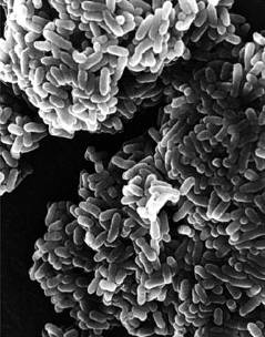 Foto: National Institute of Allergy and Infectious Diseases, National Institutes of Health